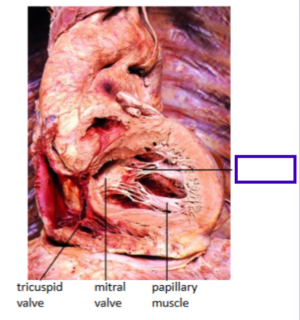 term image