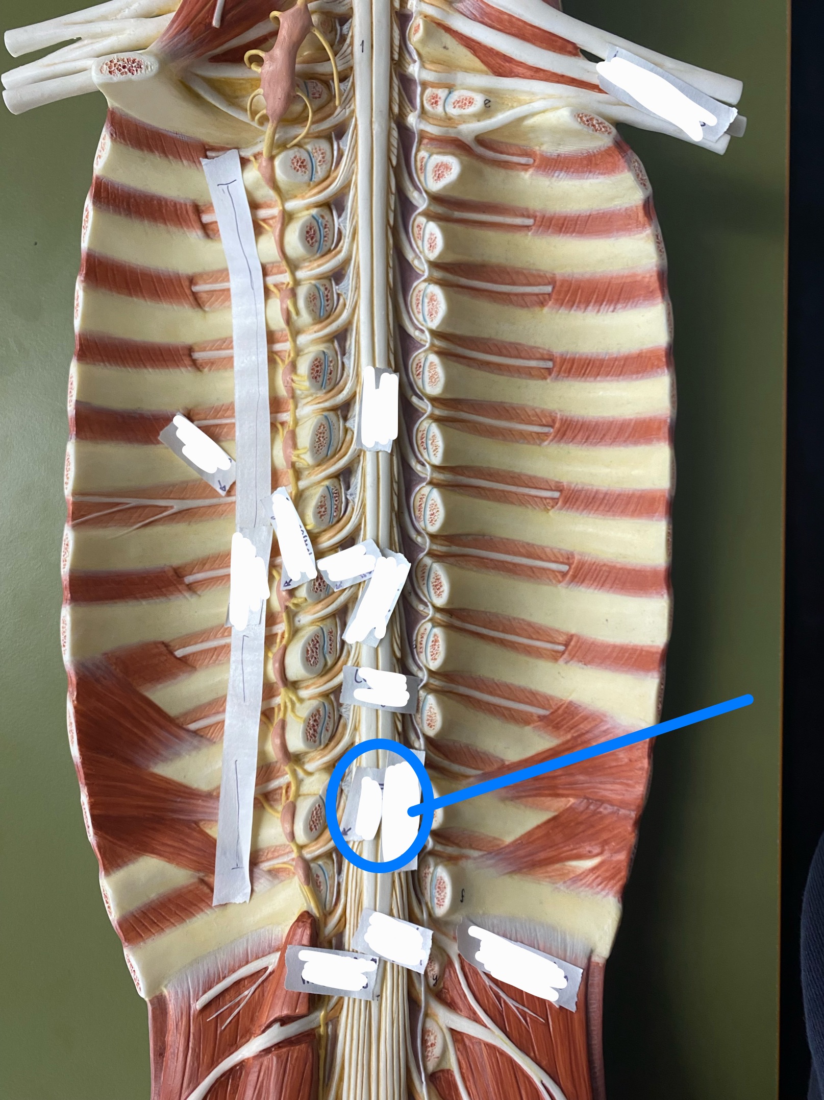 <p>ID enlargement</p>