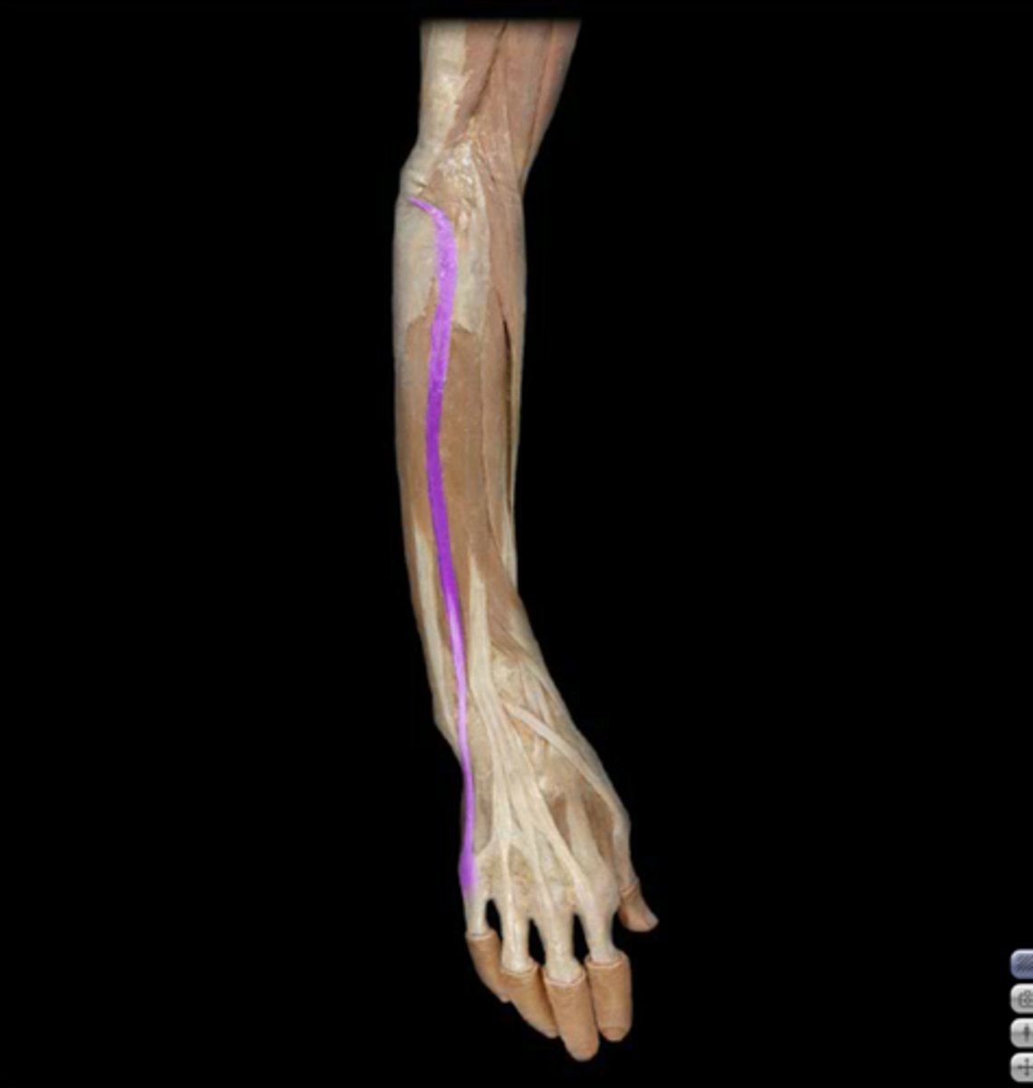 <p>Action: Digit 5 extension</p><p>Origin: Lateral epicondyle</p><p>Insertion: Digit 5 extensor expansion</p><p>Nerve innervation: Posterior interosseous nerve (PIN): continuation of deep branch of the radial nerve</p><p>Dorsal extensor compartment: 5th compartment</p>