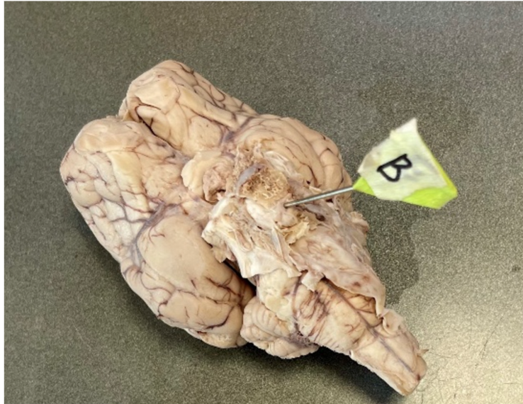 <p>What structure is pinned? </p>