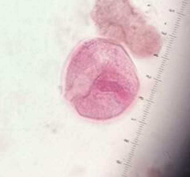 <p>Name: Balantidium coli</p><p class="p1">Stage: cyst</p>