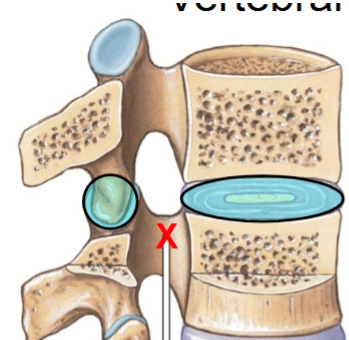 <ol><li><p>Intervertebral joint (discs): between adjacent vertebrae bodies (secondary cartilaginous joint)</p></li><li><p>Zygapophyseal joint: Between two adjacent vertebral processes (synovial joint)</p></li></ol><p></p>
