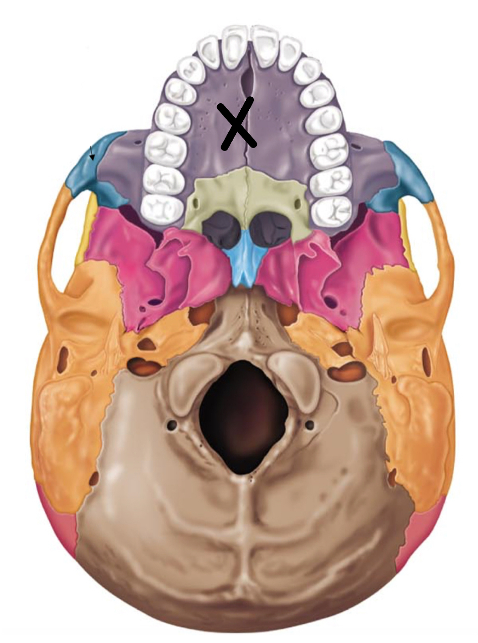 term image