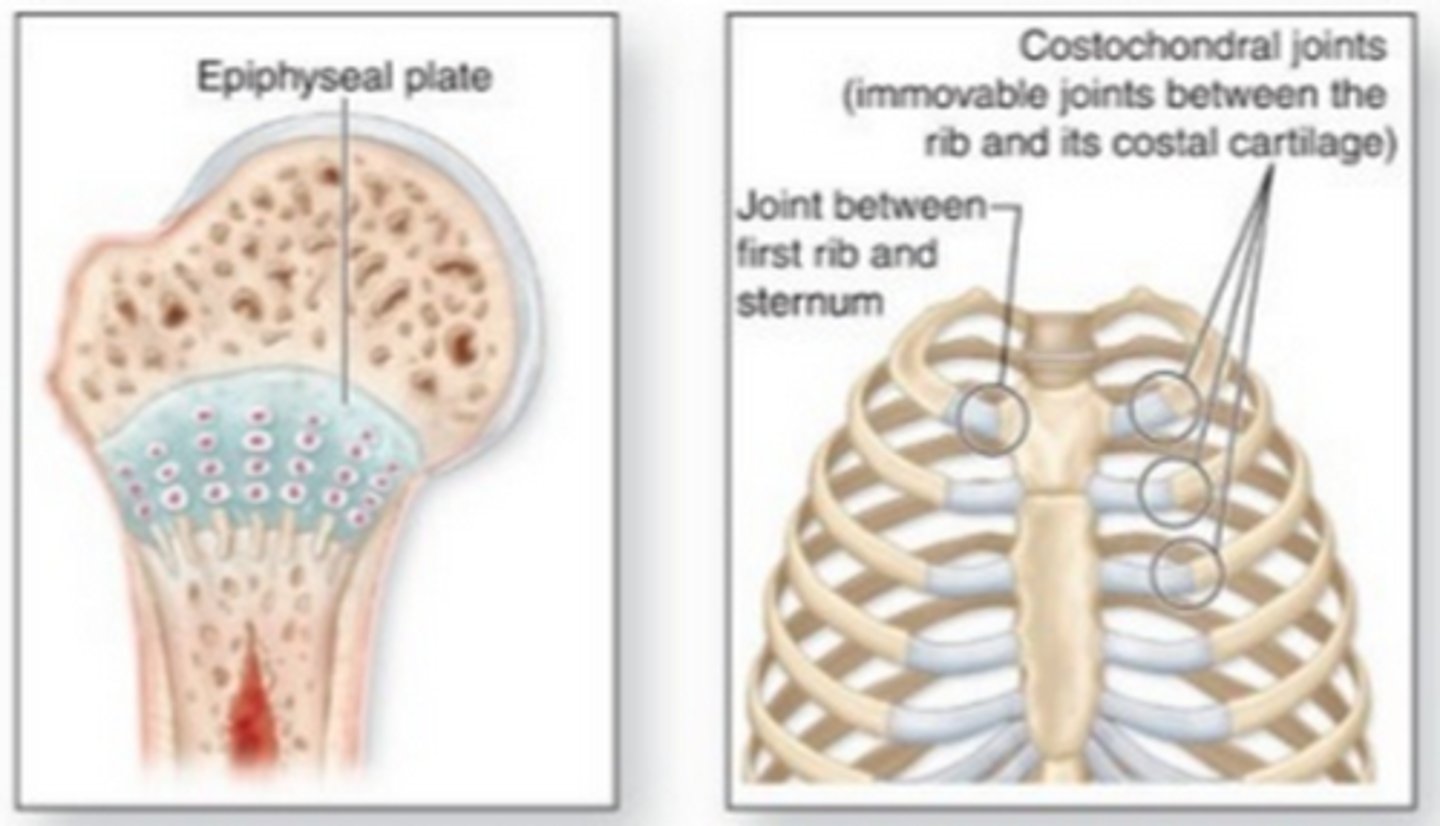 <p>cartilaginous joint in which the connecting material is hyaline cartilage. This type of joint allows for little movement.</p>