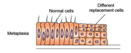 <p>replacement of one type of cell with another (change in cell type)</p>