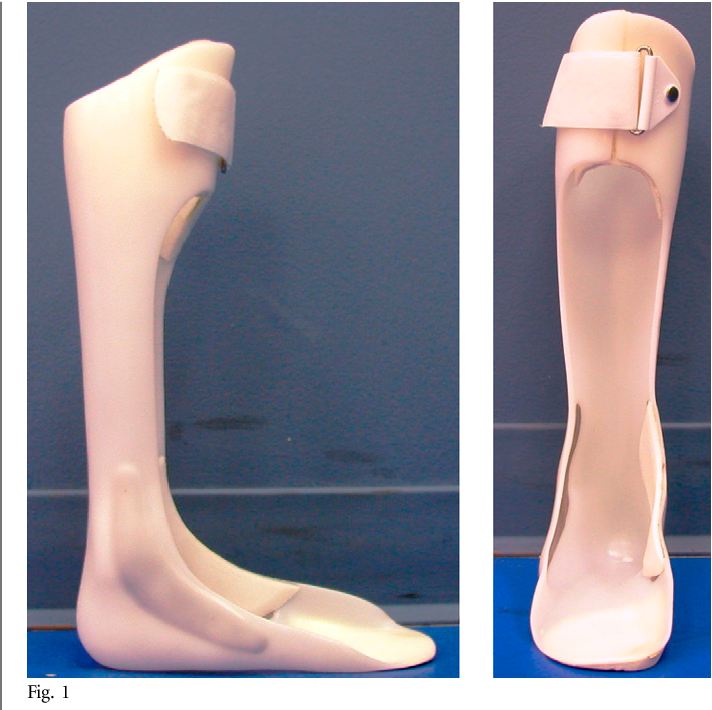 <p>proximal portion influences knee throughout gait.</p>