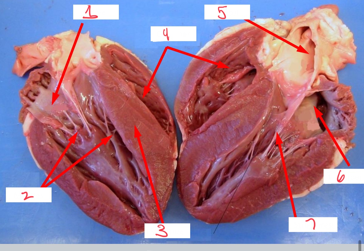 <p>What valve is 1 pointing to?</p>