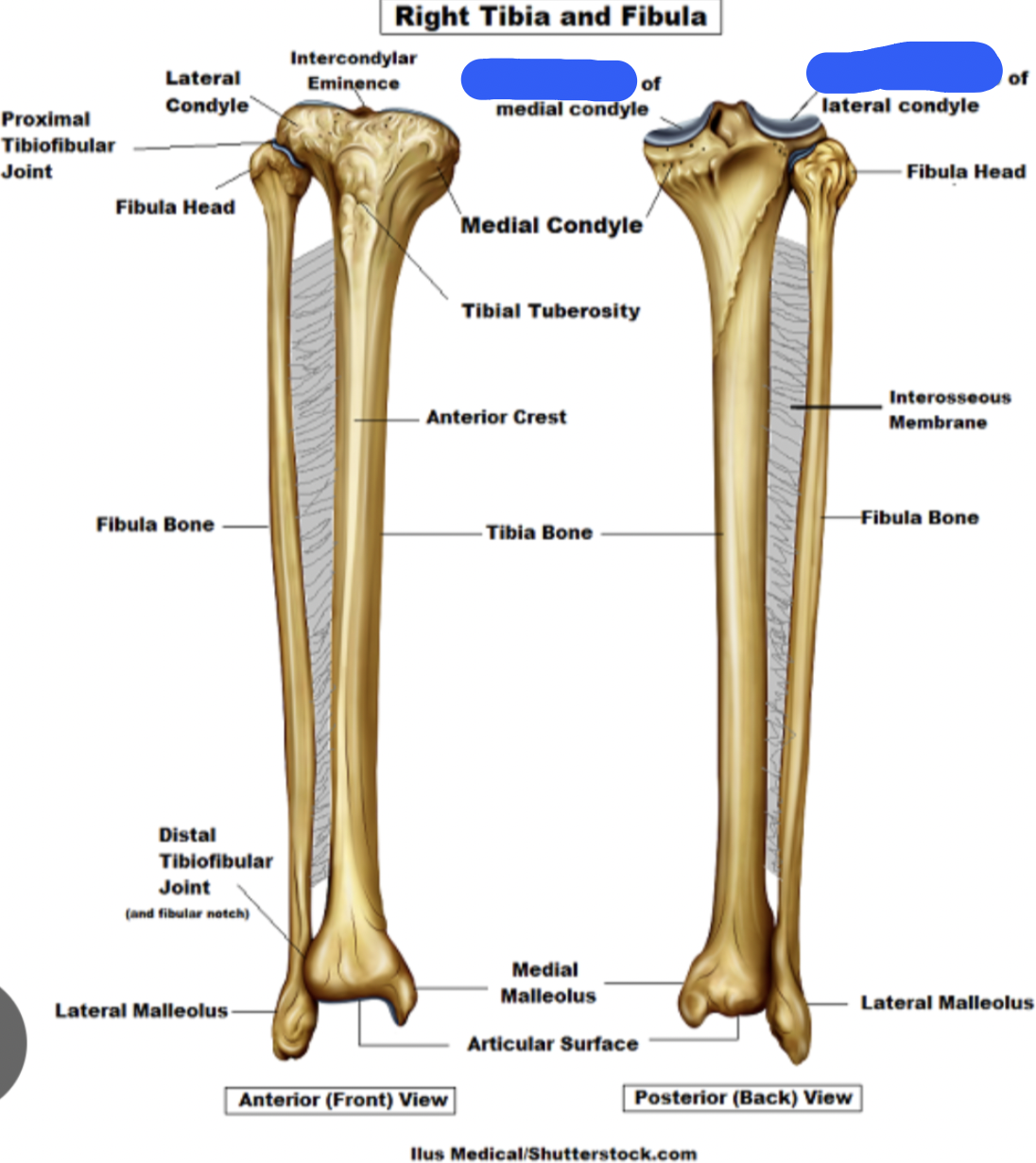 <p>tibia: </p>