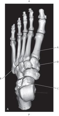 <p><span style="color: green">Which line is pointing to the medial cuneiform?</span></p>