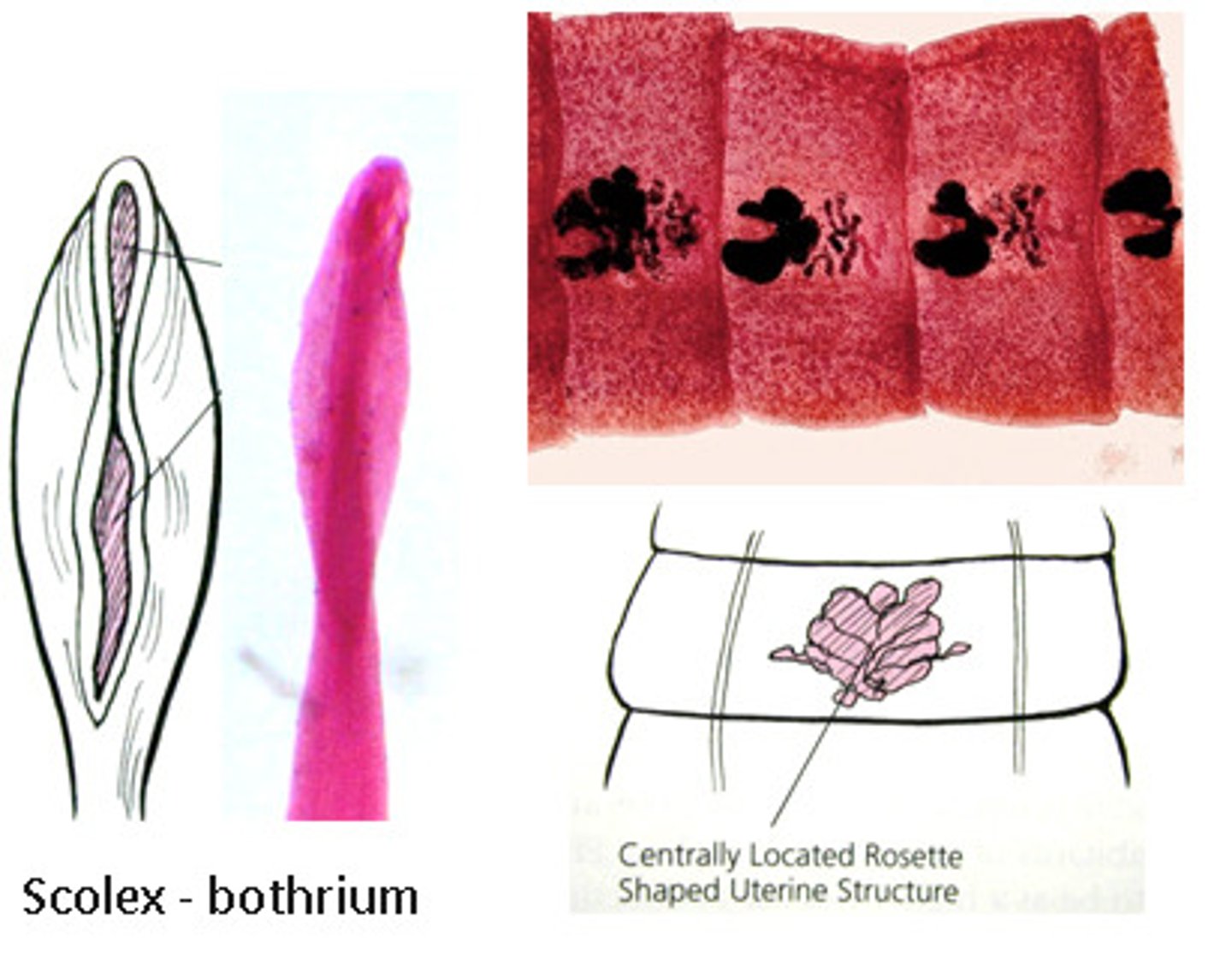 <p>"fish tapeworm"; proglottids are wide and short</p>
