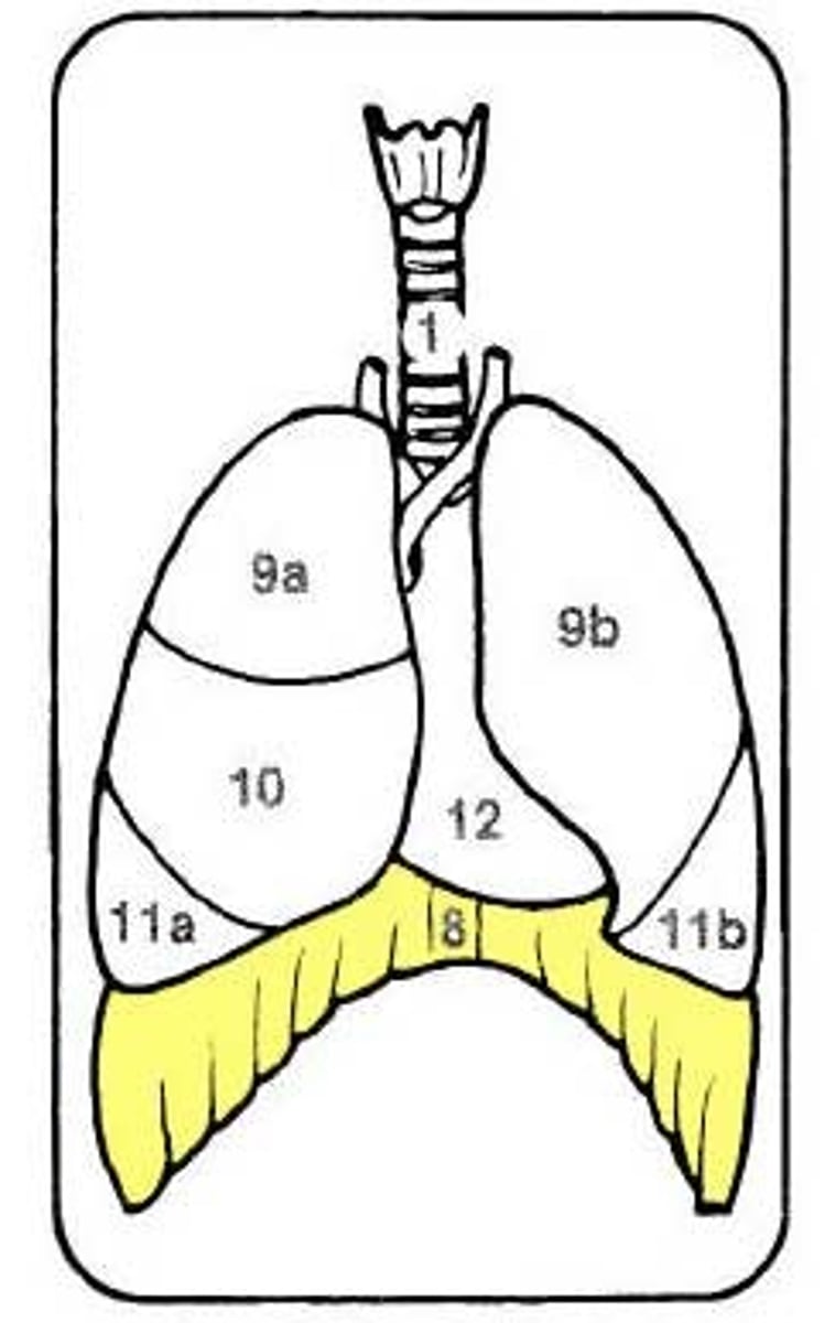 <p>Separates the thorax from the abdomen•</p><p>Central tendon is asheet-like tendon•</p><p>Fibers of ________ pull on central tendon•</p><p>_________ is pulled downward/flattens during inspiration•</p><p>Lungs are expanded in the vertical dimension</p>