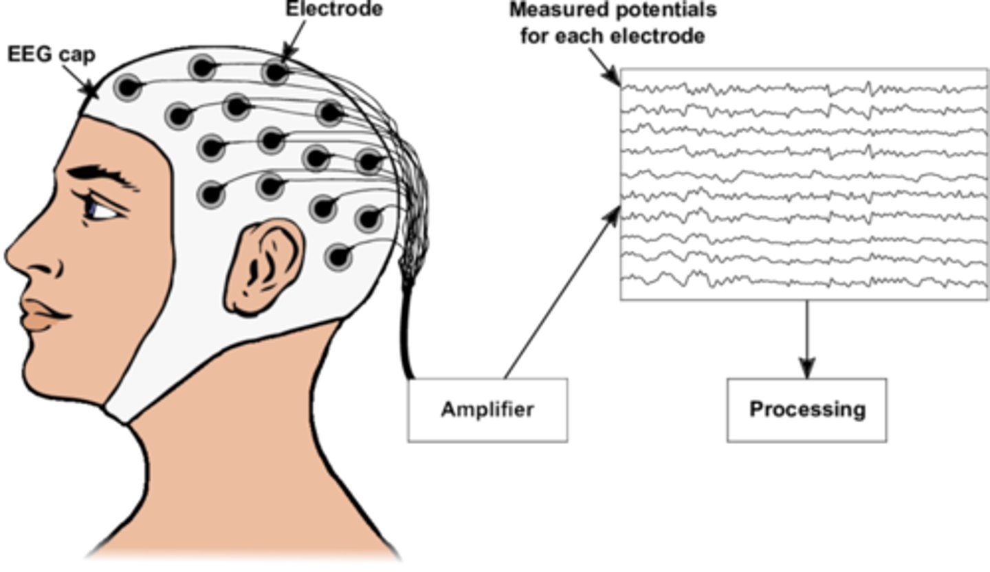 <p>- Enregistre l'activité électrique (potentiel post-synaptique) du cerveau grâce à des électrodes placées sur le cuir chevelu</p><p>- Mesure les états globaux grâce à sa bonne résolution temporelle</p><p>- Souvent utilisé chez les épileptiques</p>