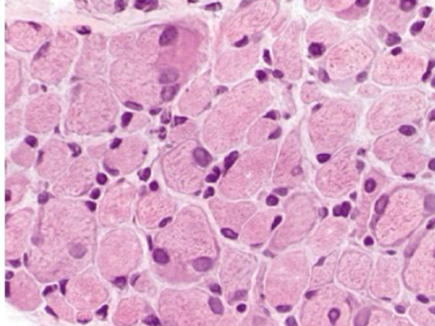 <p>What are clinical signs of Labrador retriever Centronuclear myopathy?</p>