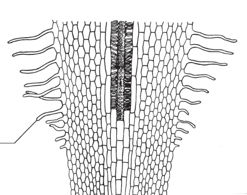 <p>What is the arrow line to?</p>