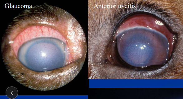 <p>Corneal Edema</p>