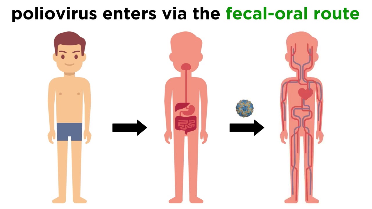 <p>Polio is transmitted through the fecal oral route</p><ul><li><p>p.f.o.r.u = polio fecal oral route = party 4 u </p></li></ul><p></p>