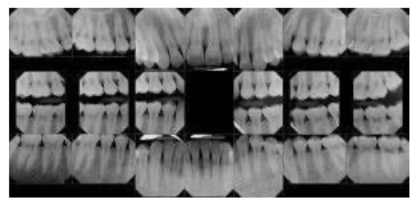 <p>every tooth in the mouth and should ALWAYS start in anterior when exposing</p>