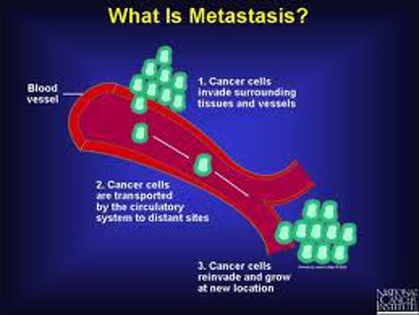 <p>This is the distant spread of cancerous cells through the bloodstream or lymphatic system</p><p>- often due to the cancerous cells being able to make the right factors such as proteases to digest basement membranes and factors that will encourage blood vessel formation then the damaged cells can reach out to other tissues</p>
