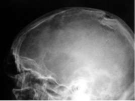 <p>What fracture is this?</p>