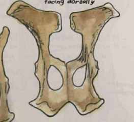 <p>has 3 distinct prominences on sciatic tuber, wide obturator foramen, with wide medial border</p>