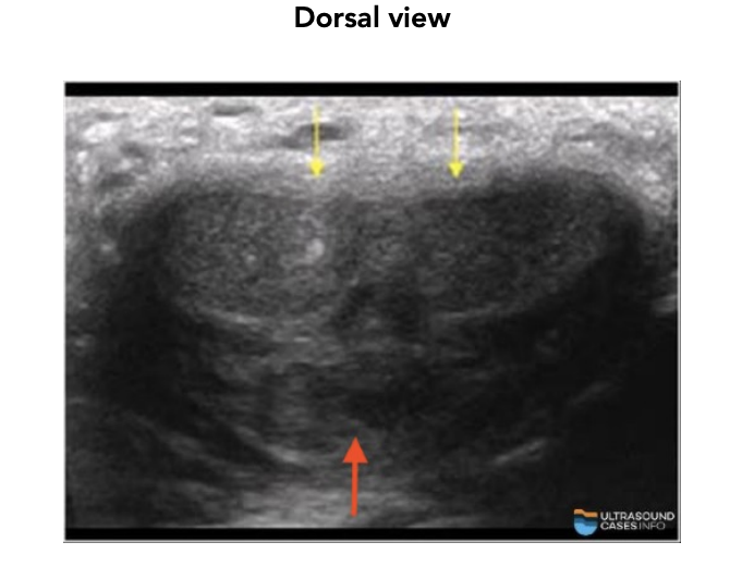 <p>urethra (red arrow)</p>