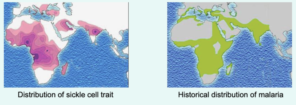 <p>the sickle cell trait is more prevalent in areas of endemic malaria</p><p>red cells with HbS <strong>more fragile and prone to ruptur</strong>e when infected with the plasmodium parasite (causing malaira), which impairs the parasite’s ability to reproduce</p><p></p><p>HbS less digestible for the parasite than HbA</p>