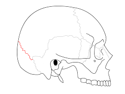 between the parietal bones and the occipital bone