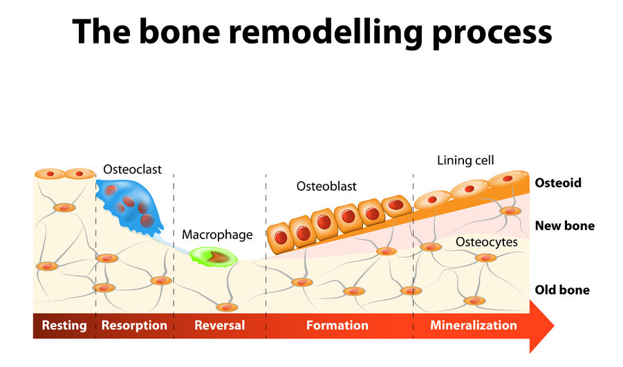 <ol><li><p>Osteocytes release chemical signals to tell osteoclasts to go to the damage</p></li><li><p>Osteocalsts release enzymes there that allow them to digest the calcium phosphate, putting the calcium and phosphate back into the blood (resorption)</p></li><li><p>Macrophages promote bone tissue remodeling</p></li><li><p>Osteoblasts come in and build new bone before they undergo apoptosis</p></li></ol>