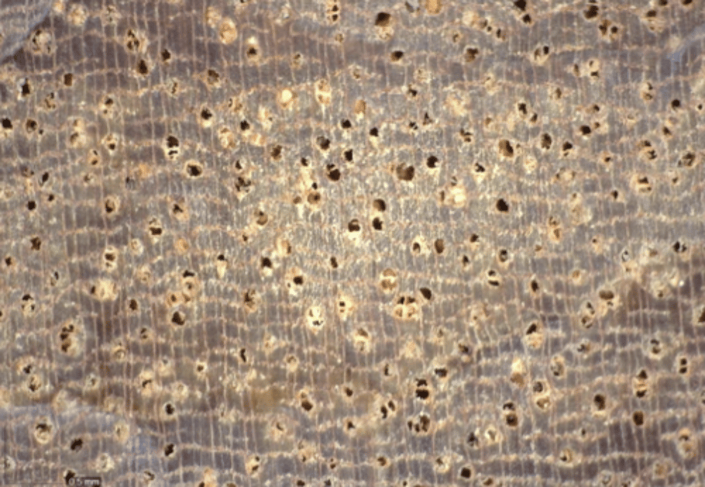 <p>Reddish to walnut brown, moderately small pores. tyloses and orange deposits, concentric parenchyma</p>