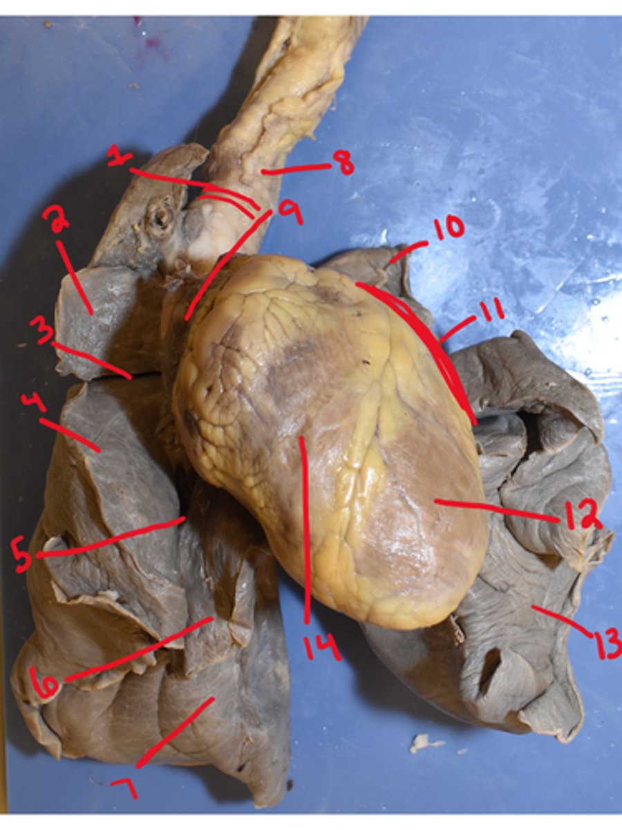 <p>What is structure #13</p>