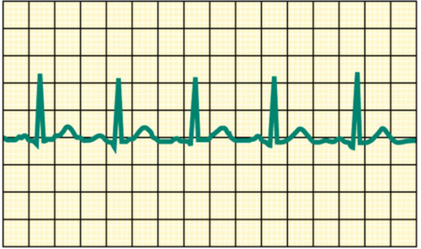 <p>Name the recording.</p>