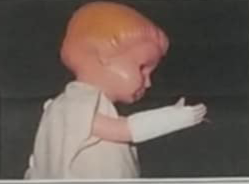<p>Short Arm Circular Cast</p>