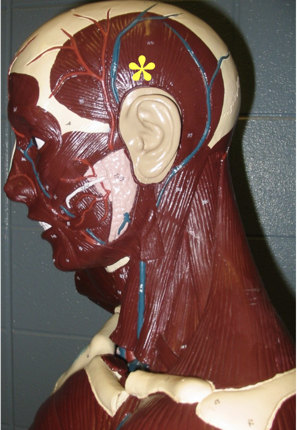<p>Action: Elevates and retracts mandible</p><p>Insertion: Coronoid proces</p>