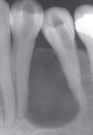 <p>Notice other radiographic Features?</p>