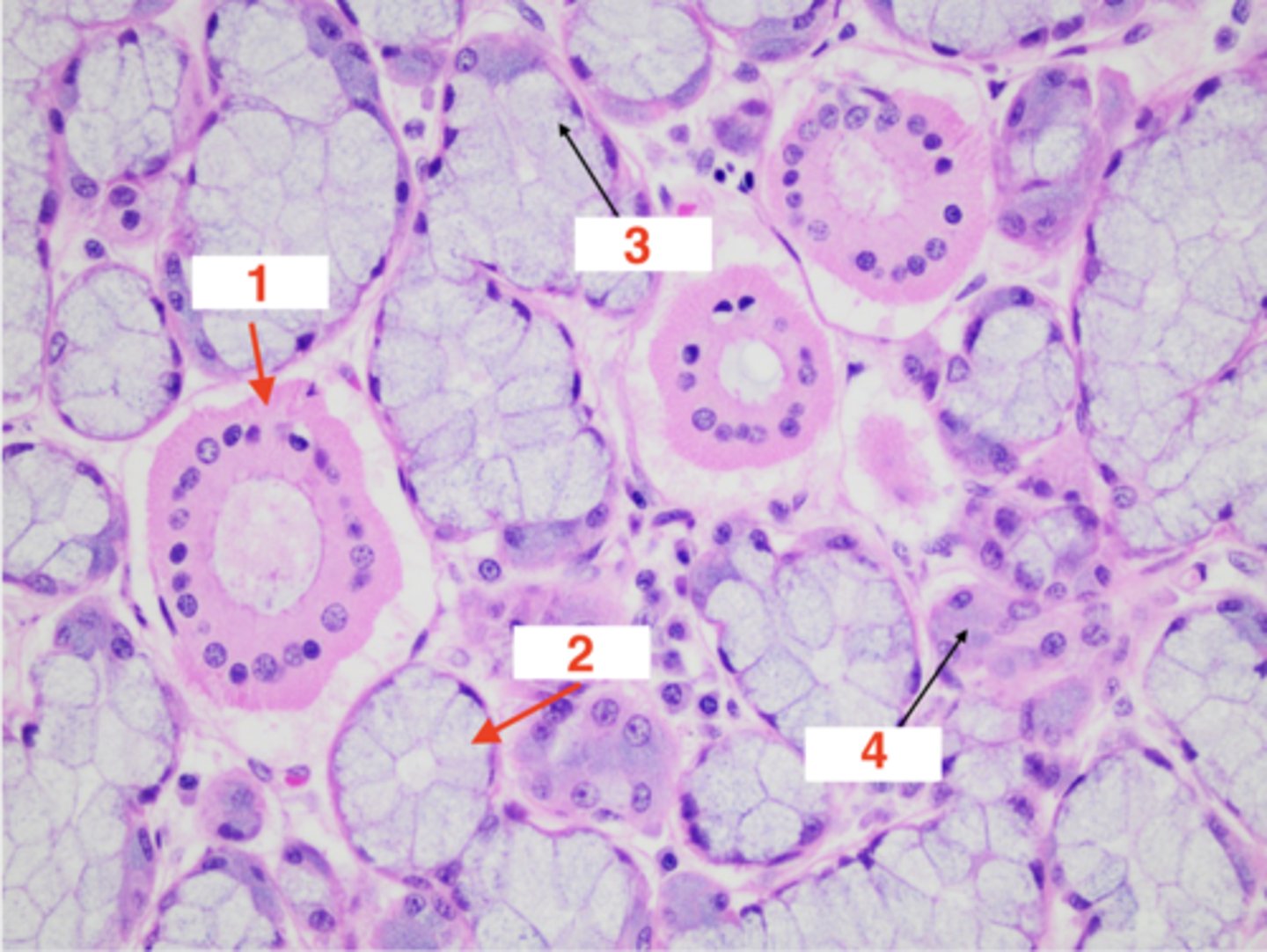 <p>4 (type of epithelial cell in acini)</p>