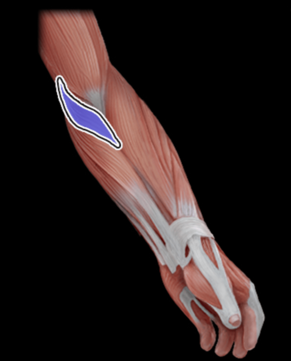 <p>What Muscle Is Highlighted?</p>