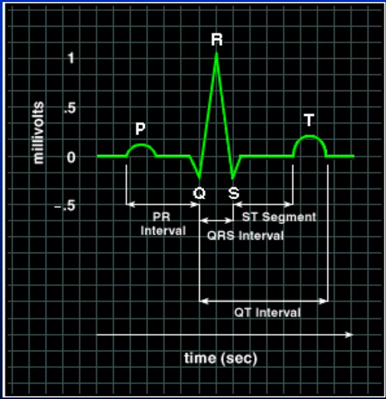 <p>P: atrial depolarization P-R: SA to AV QRS: ventricular depolarization T: ventricular repolarization</p>