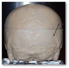 Name this suture.