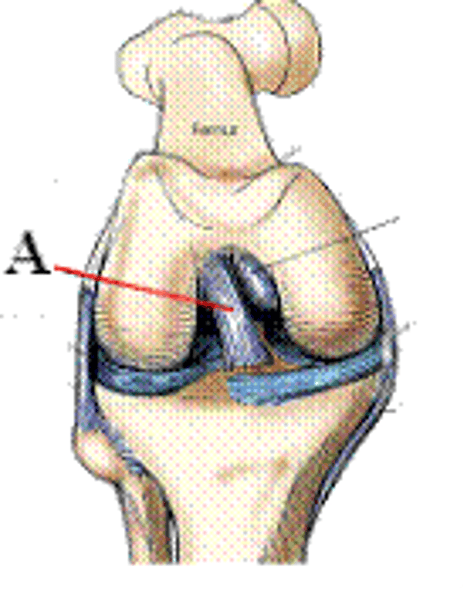 <p>anterior cruciate ligament</p>