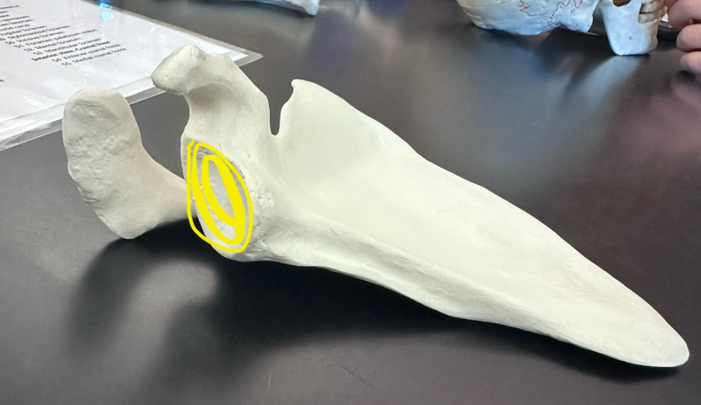 <p>What is highlighted in yellow?</p>