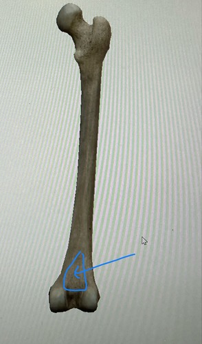 term image