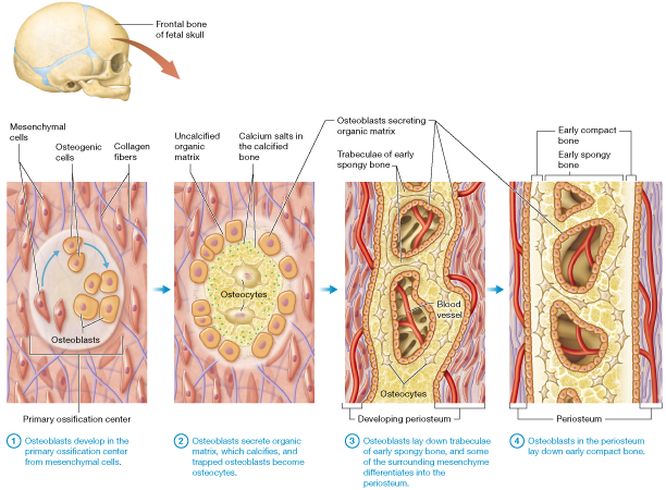 <ol><li><p><strong>Formation of a starting tissue</strong>: Mesenchymal (connective) tissue becomes full of blood vessels and rapidly grows.</p></li><li><p><strong>Osteoblast formation</strong>: Some cells in the tissue turn into osteoblasts (bone-forming cells) and start creating osteoid (soft bone material).</p></li><li><p><strong>Bone hardening</strong>: The osteoid is replaced by hard, lamellar bone over time.</p></li></ol><p></p>