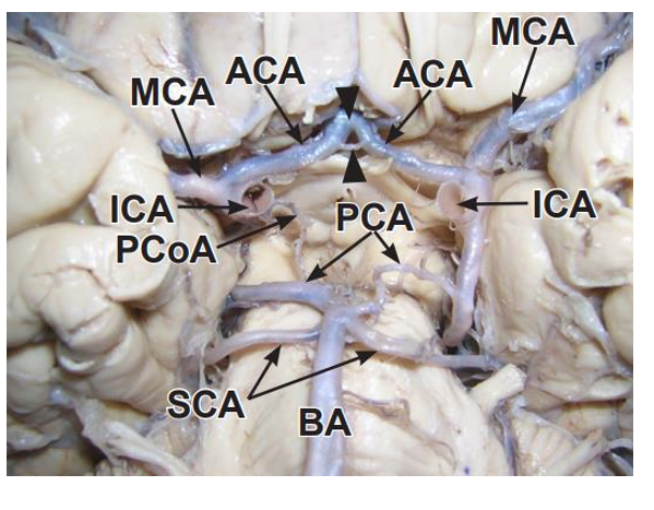 knowt flashcard image