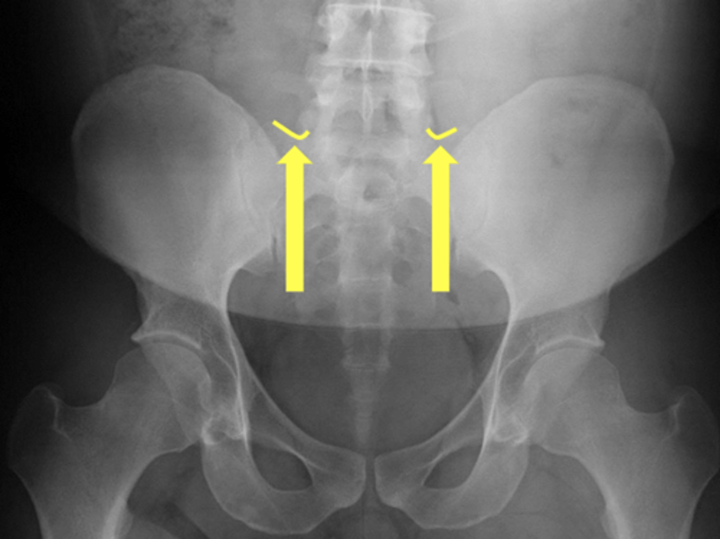 <p>What are the yellow arrows pointing to?</p>