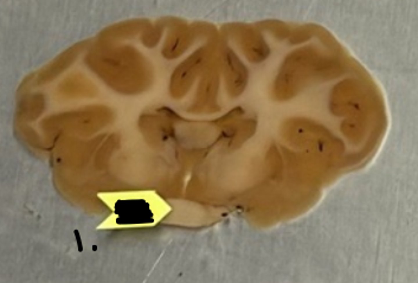 <p>what structure is labeled as #1 ?</p>