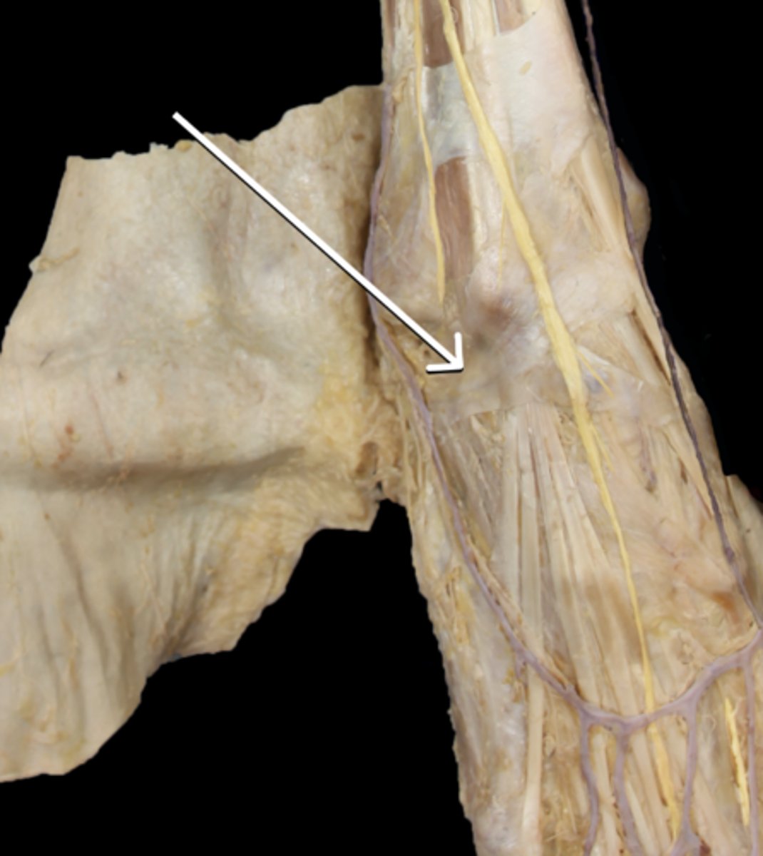 <p>Identify the structure</p>