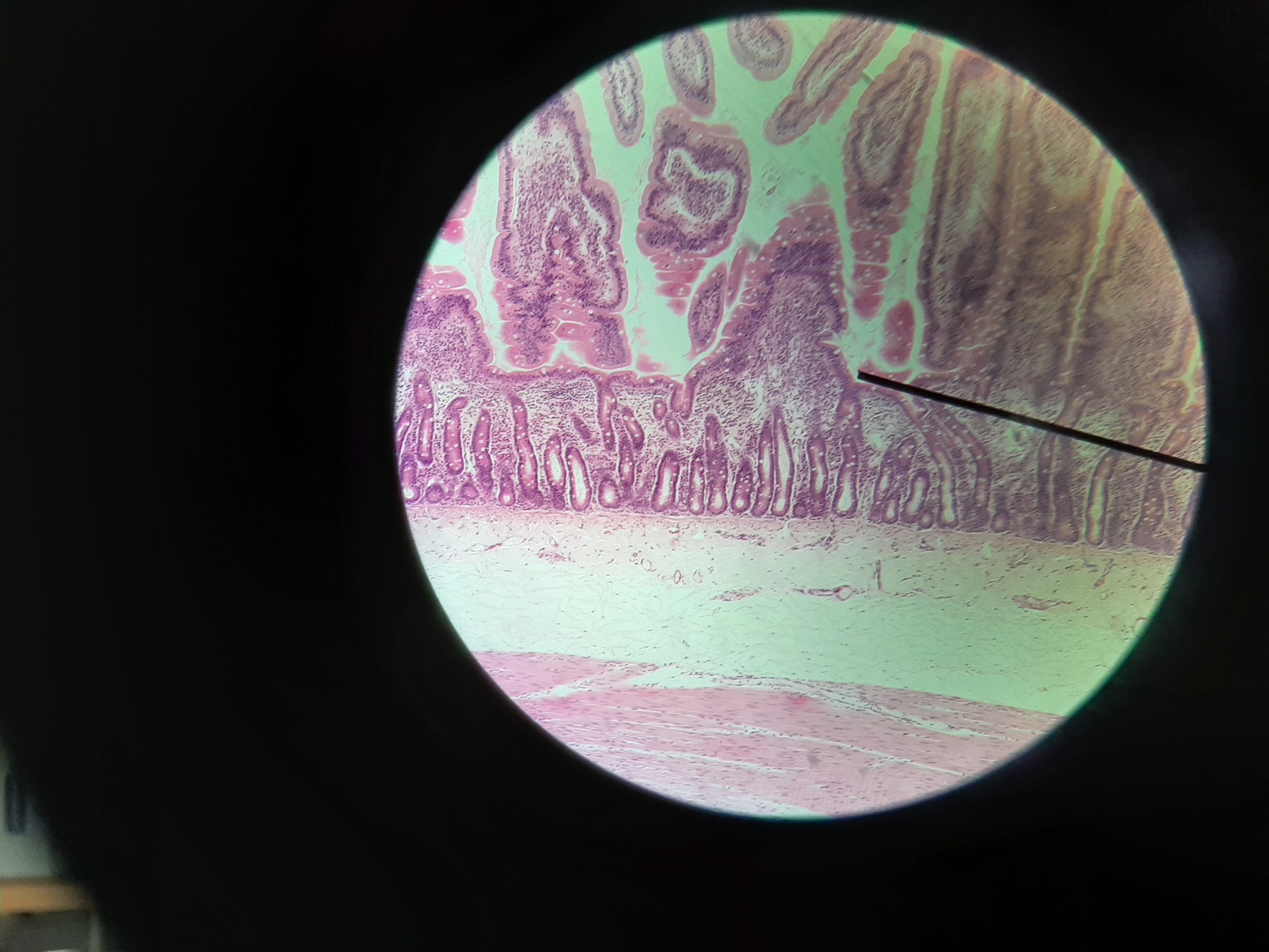 term image