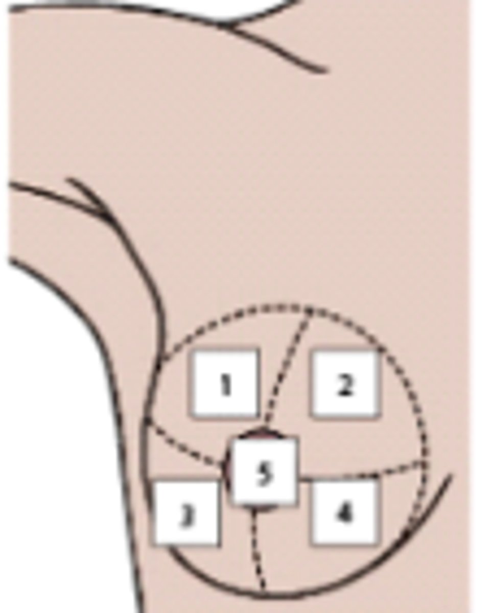 <p>When using the accompanying illustration to teach a patient about breast self-examination, the</p><p>nurse will include the information that most breast cancers are located in which part of the</p><p>breast?</p><p>a. 1</p><p>b. 2</p><p>c. 3</p><p>d. 4</p><p>e. 5</p>