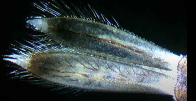 <p>What body part is this from damselfly larvae?</p>