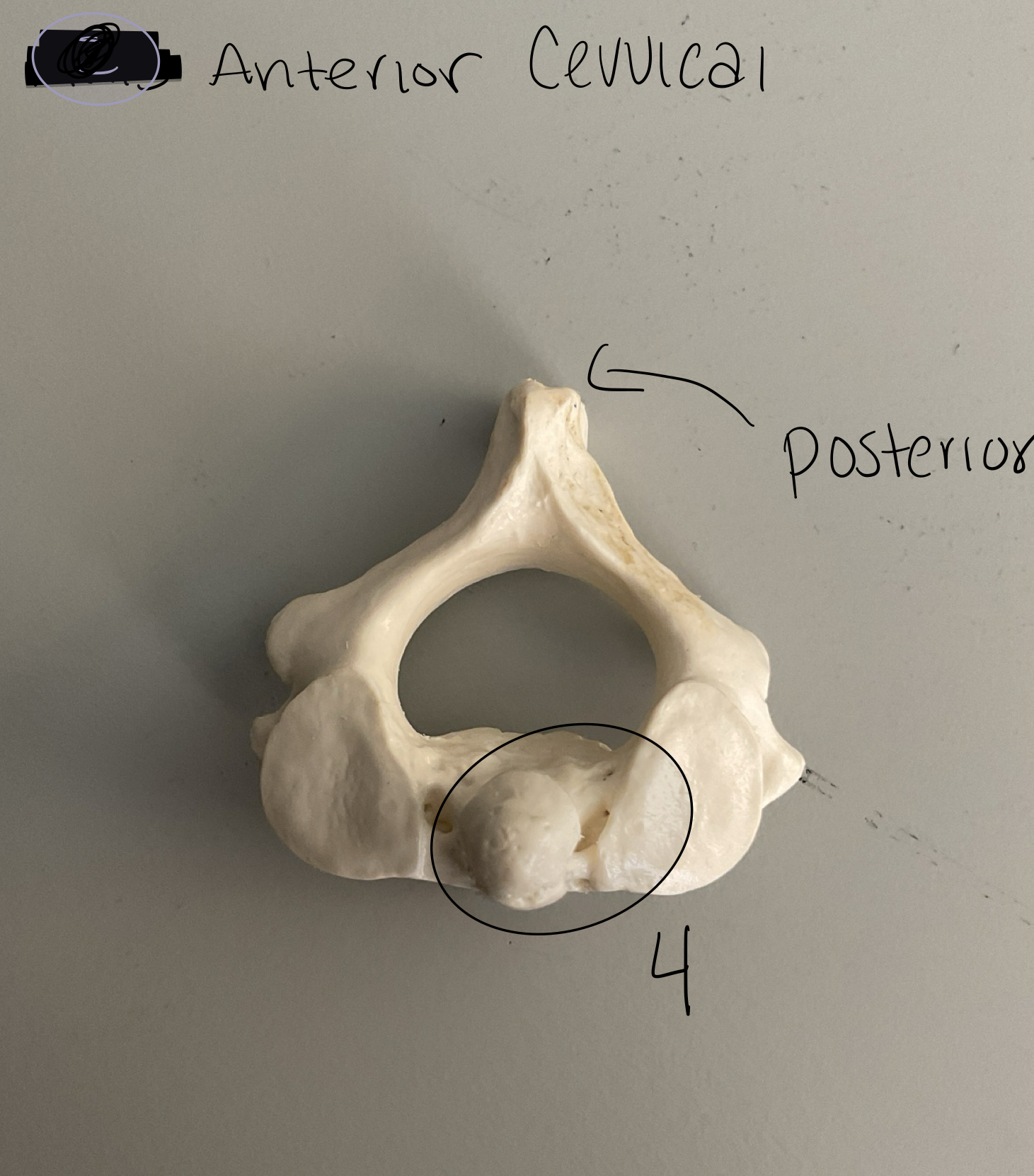 <p>4 from axis</p>